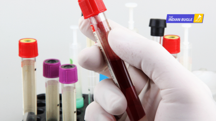 Five Thalassemia-Affected Children in Chaibasa Test HIV Positive, Five Thalassemia-Affected Children in Chaibasa Test HIV Positive,