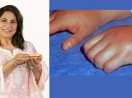 Archana Puran Singh and CRPS — A Clear, Deep Guide to Her Condition, Care, and Recovery Path