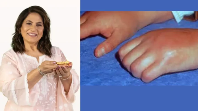 Archana Puran Singh and CRPS — A Clear, Deep Guide to Her Condition, Care, and Recovery Path