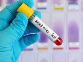 Nipah Virus in West Bengal: Two confirm cases, Risks, and What You Need to Know Nipah Virus in West Bengal: Two confirm cases, Risks, and What You Need to Know