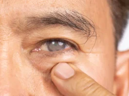 Glaucoma vs Cataract: How They Are Similar, How They Differ, and Why Early Care Matters Glaucoma vs Cataract: How They Are Similar, How They Differ, and Why Early Care Matters