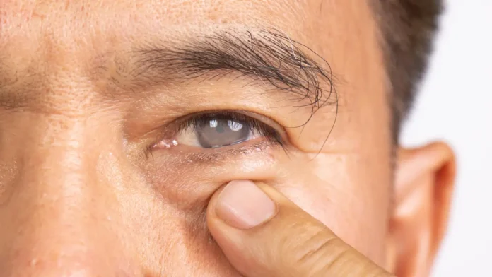 Glaucoma vs Cataract: How They Are Similar, How They Differ, and Why Early Care Matters